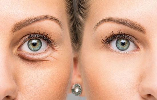 best-eye-specialist-in-chembur